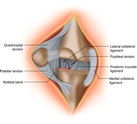 Valgus Knee Severe Cases Included Musculoskeletal Key