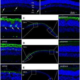 Osteopontin Opn Expression In Blue Led Induced Rd Retinas A