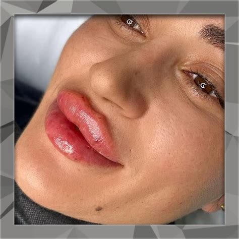 Russian Lip Masterclass £695 The Marie Brown Aesthetics Academy