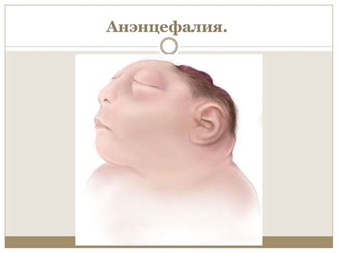 Врождённые заболевания - презентация онлайн