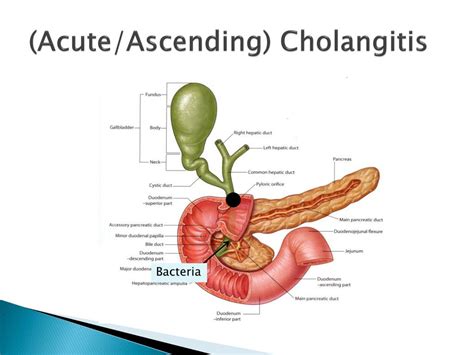 Ppt The Liver Gallbladder And Biliary Tree Powerpoint Presentation