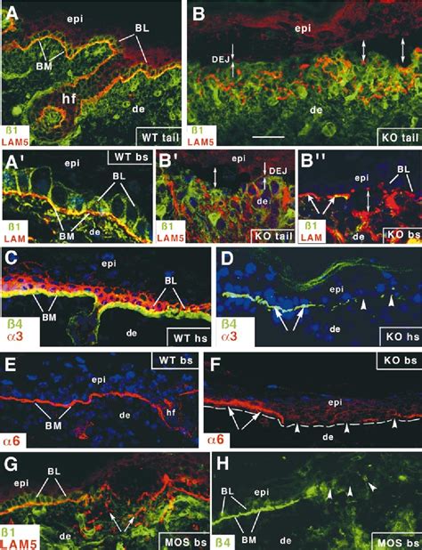 Figure From Conditional Ablation Of Beta Integrin In Skin Severe