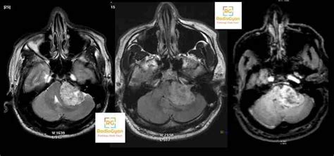 Radiology Spotters Kahoot Spotters Set Radiogyan Radiogyan