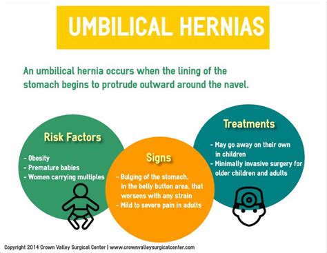 Umbilical Hernias Infographic Umbilical Hernia Surgery Center