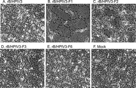 Formation Of Syncytia On Cell Monolayers Infected With The Rb Hpiv3 Download Scientific Diagram