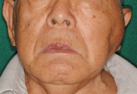 Clinical Findings At The Initial Visit Obvious Swelling Redness And