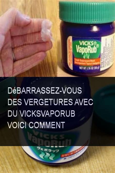 D Barrassez Vous Des Vergetures Avec Du Vicksvaporub Voici Comment