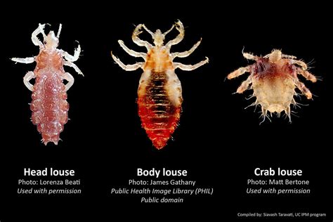 How To Distinguish Between Head Body And Crab Lice Urban Ipm Socal