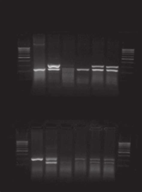 Gel Electrophoresis Representative Of Polymerase Chain Reaction Pcr Download Scientific