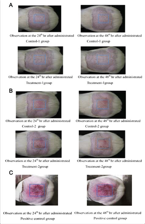 Skin Sensitization Study A Pictures For Observation Of Skin Reaction