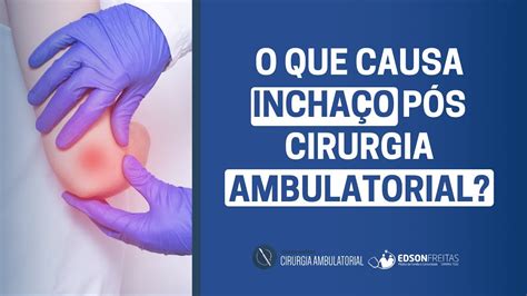 O Que Causa Incha O P S Cirurgia Ambulatorial Youtube