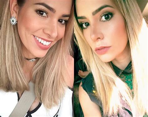 Foto Adriana Sant Anna Fez Nova Pl Stica No Nariz Em