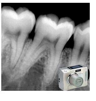 Rvg Digital Dental X Ray In Madurai Id