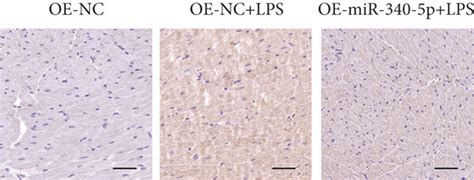 The Effect Of The Mir P Overexpression On Cardiac Function