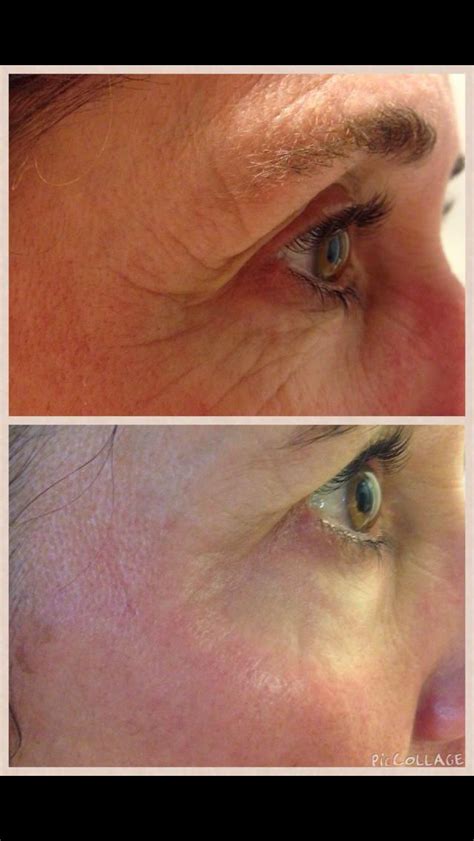 Redefine Acute Care Photos Before And After