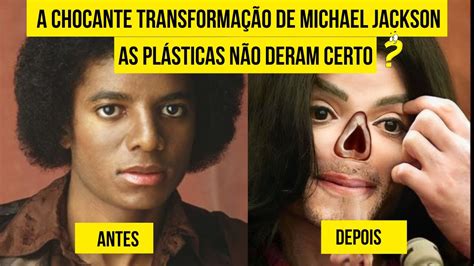 A chocante transformação de Michael Jackson cirurgias plásticas não