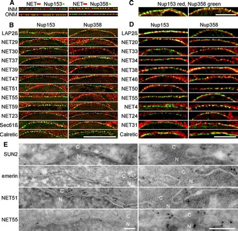 INM Versus ONM Targeting NETs Were Imaged Using High Resolution