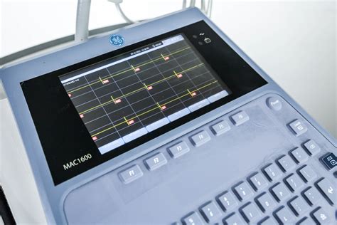 Ge Healthcare Mac 1600 Ekg Elektrokardiograf Arestomed