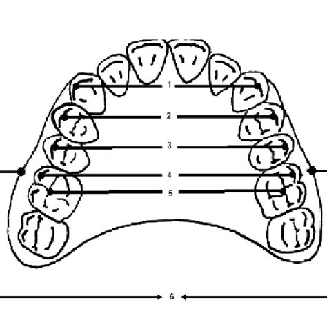 Arch Width Measurements On Maxillary Study Model Download Scientific