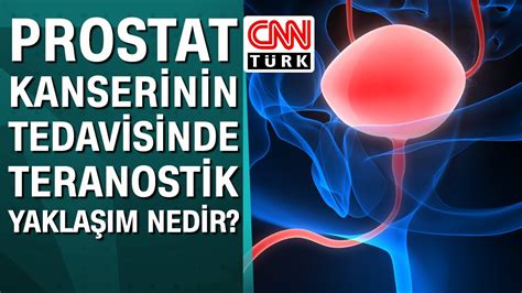 Prostat Kanserinin Tedavisinde Teranostik Yakla M Nedir Youtube