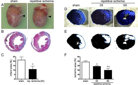 Reduced Infarct Size And Decreased Area At Risk After Ischemia Induced