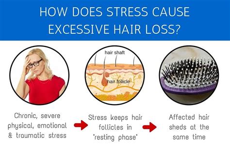 What Are The Causes Of Hair Loss By Institute Cosmetique Nov 2023