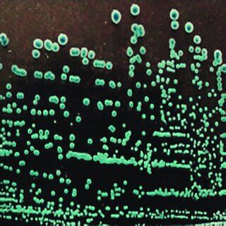 Morphology Of Escherichia Coli Colonies Chromogenic E