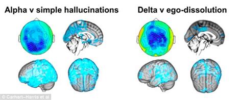 Scans Reveal How Lsd Alters The Brain To Mimic The Way Babies See The