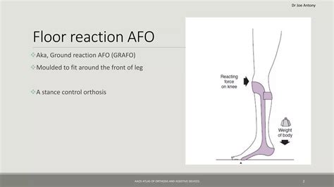 Floor Reaction Ankle Foot Orthosis Or Gravity Reaction Ankle Foot