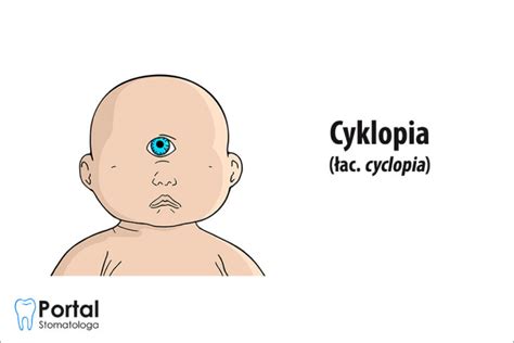 Cyklopia Portal Stomatologa