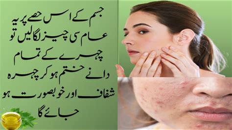 How To Remove Acne Pimples In One Day Face Acne Treatment Chehre Ke