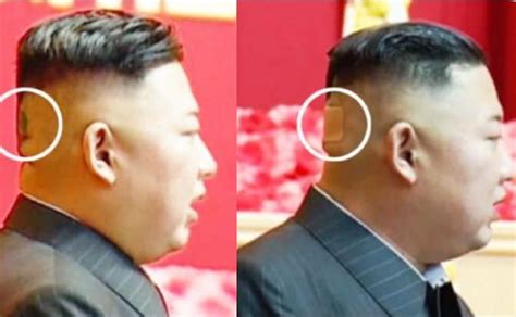 Kim Jong un reaparece en público con una mancha en la cabeza se