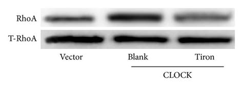 Effect Of Ros Levels On Rhoa And Nf κb Pathways A Western Blot