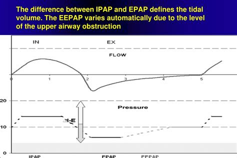 PPT Adaptive Servo Ventilation Anticyclic Modulated Ventilation