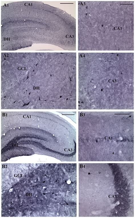 Figures A2a4 Show Magnified Views Of The Dentate Gyrus The Ca1