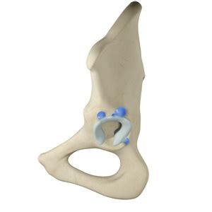 Labral Cysts Of The Hip Murray Ut Anterior Hip Pain Murray Ut