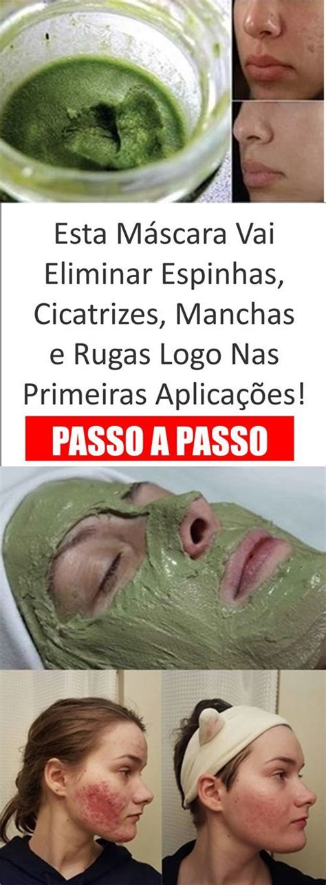 O Que Fazer Para Eliminar Cravos E Espinhas Passo A Passo Espinhas