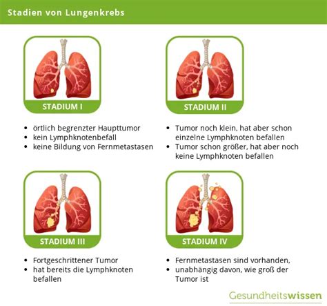 Lungenkrebs Ursachen Behandlung Vorsorge Das Rauchen