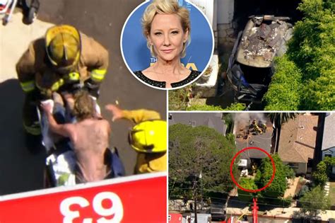 Actress Anne Heche Severely Burned In Fiery Car Crash Nation Online