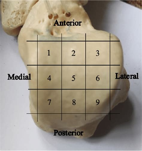 Anatomical Zone Grid System Of The Talar Dome The Talar Dome Is