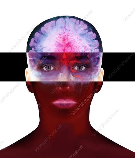 brain scan stock image p science photo library