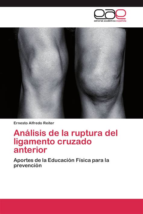 Análisis de la ruptura del ligamento cruzado anterior 978 3 8484 5660