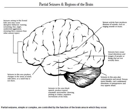 Focal Impaired Awareness Seizures | Epilepsy Foundation