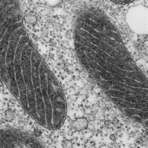 Mitochondria Electron Micrograph Labelled