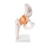 Life Size Hip Joint Model HiTech Therapy Online