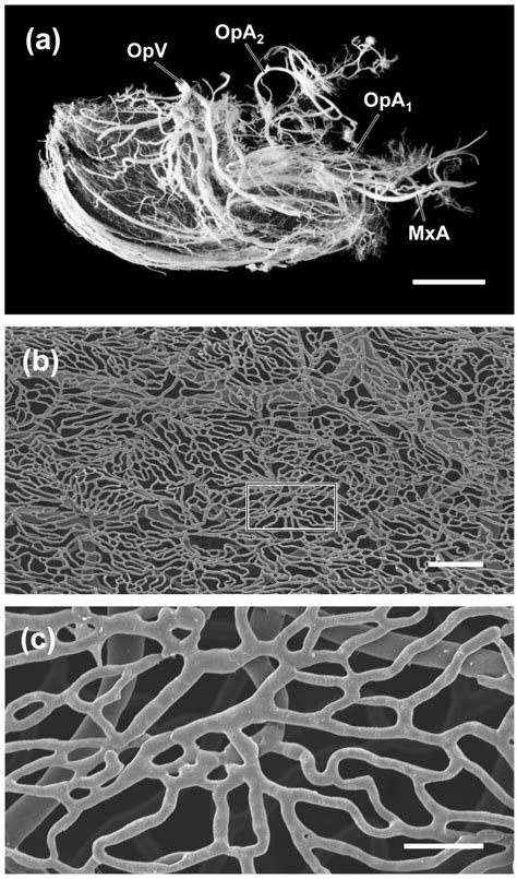 Lateral View Of The Corrosion Cast Of The Right Operculum Of