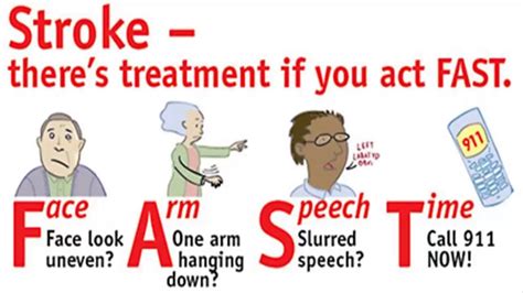 14 Warning Signs And Symptoms Of Stroke Medicineblog