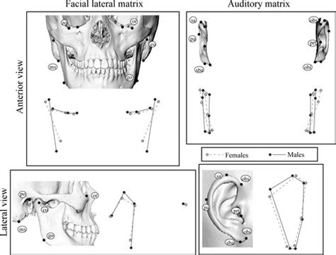 Sexual Dimorphism Of The Facial Lateral And Auditory Matrices Detected Download Scientific