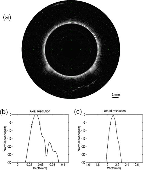 A An Ultrasound B Scan Image Of The Wire Phantom With B Axial And