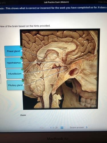 Anatomy And Physiology 2 Lab Exam 1 MIDTERM Flashcards Quizlet